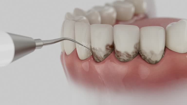 Trusted Tooth Extraction service in Landover Hills, MD - Dentist Open Now